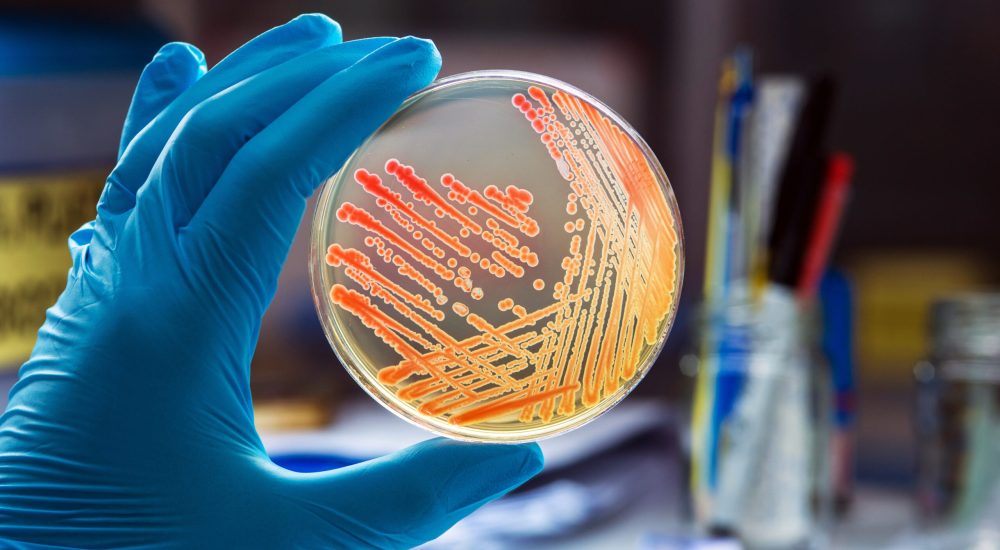 Colonies bacteria gram negative bacilli/ Gram negative cocco bacilli .